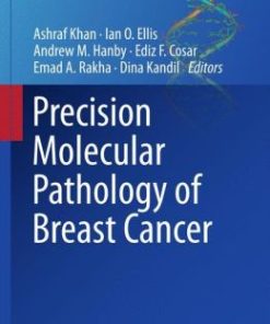 Precision Molecular Pathology of Breast Cancer (EPUB)