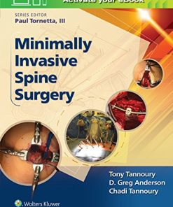 Minimally Invasive Spine Surgery (Epub)