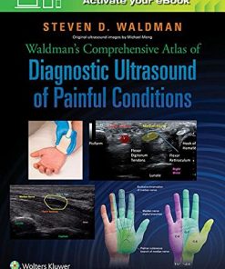 Waldman’s Comprehensive Atlas of Diagnostic Ultrasound of Painful Conditions (EPUB)