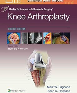 Master Techniques in Orthopedic Surgery: Knee Arthroplasty, 4th Edition (PDF)