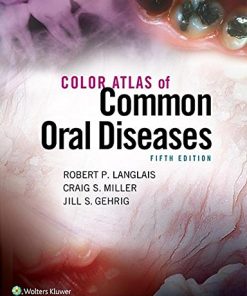 Color Atlas of Common Oral Diseases, 5th Edition (EPUB)