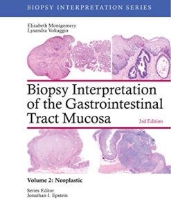 Biopsy Interpretation of the Gastrointestinal Tract Mucosa: Volume 2: Neoplastic (Biopsy Interpretation Series), 3rd Edition (EPUB)