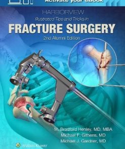 Harborview Illustrated Tips and Tricks in Fracture Surgery, 2ed (ePUB)