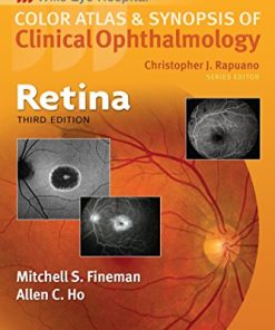 Retina (Color Atlas and Synopsis of Clinical Ophthalmology) (ePUB)