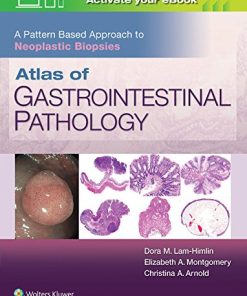 Atlas of Gastrointestinal Pathology: A Pattern Based Approach to Neoplastic Biopsies (ePUB)