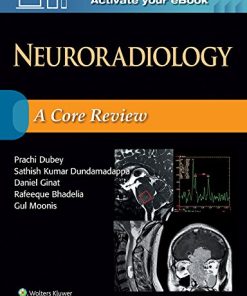 Neuroradiology: A Core Review (Epub)