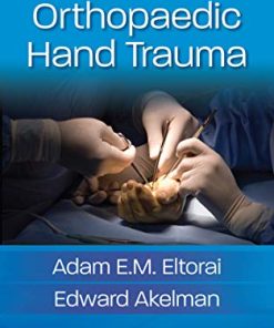 Orthopaedic Hand Trauma (EPUB)