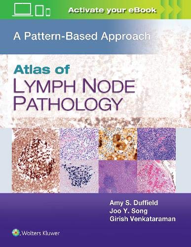 Atlas of Lymph Node Pathology: A Pattern Based Approach (ePub & Converted PDF) Atlas of Lymph Node Pathology: A Pattern Based Approach (ePub & Converted PDF)