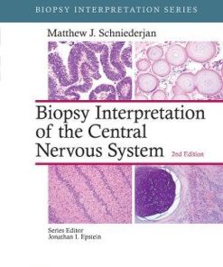 Biopsy Interpretation of the Central Nervous System, 2nd Edition (EPUB)