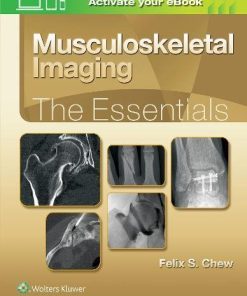 Musculoskeletal Imaging: The Essentials (ePUB)