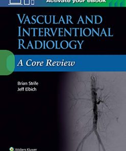 Vascular and Interventional Radiology: A Core Review (EPUB)