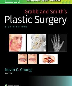 Grabb and Smith’s Plastic Surgery, 8th Edition (High Quality Scanned PDF)