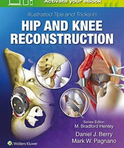 Illustrated Tips and Tricks in Hip and Knee Reconstructive and Replacement Surgery (EPUB)