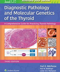 Diagnostic Pathology and Molecular Genetics of the Thyroid: A Comprehensive Guide for Practicing Thyroid Pathology (ePub+Converted PDF)