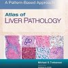 Atlas of Liver Pathology: A Pattern-Based Approach (ePub+Converted PDF)