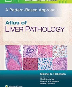 Atlas of Liver Pathology: A Pattern-Based Approach (ePub+Converted PDF)