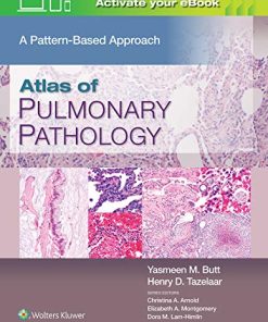 Atlas of Pulmonary Pathology: A Pattern Based Approach (azw3+epub+Converted PDF)