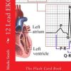 12 Lead EKG: The Flash Card Book (EPUB)