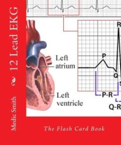 12 Lead EKG: The Flash Card Book (EPUB)