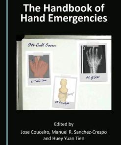 The Handbook of Hand Emergencies (PDF)