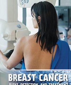 Breast Cancer: Risks, Detection, and Treatment (Diseases & Disorders) (PDF)