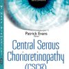 Central Serous Chorioretinopathy: Risk Factors, Diagnosis and Management (PDF)