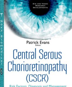 Central Serous Chorioretinopathy: Risk Factors, Diagnosis and Management (PDF)