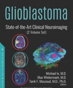 Glioblastoma: State-of-the-art Clinical Neuroimaging, 2 Volume Set (PDF)