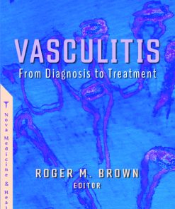 Vasculitis: From Diagnosis to Treatment (PDF)