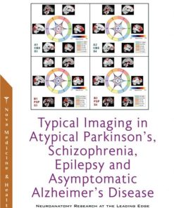 Typical Imaging in Atypical Parkinson’s, Schizophrenia, Epilepsy and Asymptomatic Alzheimer’s Disease (PDF)