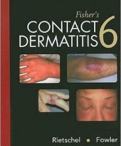 Fisher’s Contact Dermatitis, 6th Edition (PDF)