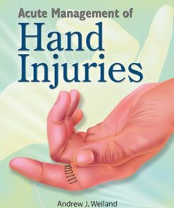 Acute Management of Hand Injuries (PDF)