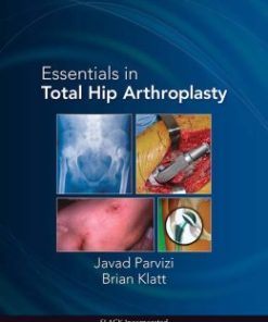 Essentials in Total Hip Arthroplasty (PDF)