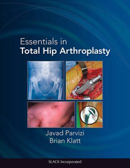 Essentials in Total Hip Arthroplasty (PDF) Essentials in Total Hip Arthroplasty (PDF)
