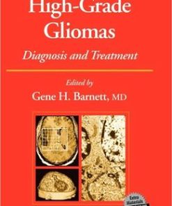 High-Grade Gliomas: Diagnosis and Treatment (PDF)