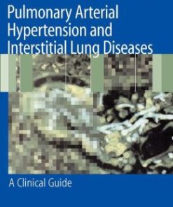 Pulmonary Arterial Hypertension and Interstitial Lung Diseases: A Clinical Guide (EPUB)