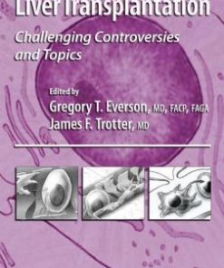 Liver Transplantation: Challenging Controversies and Topics (EPUB)