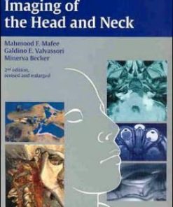 Imaging of the Head and Neck, 2nd Edition