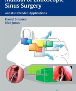 Manual of Endoscopic Sinus Surgery: and its Extended Applications