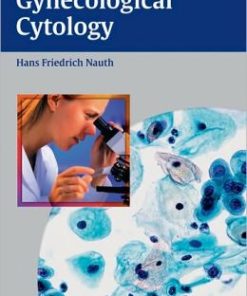 Gynecologic Cytology