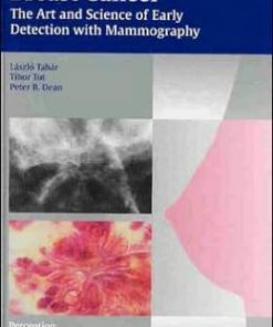 Breast Cancer – The Art and Science of Early Detection with Mammography: Perception, Interpretation, Histopathologic Correlation