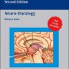 Neuro-Oncology (Neurosurgical Operative Atlas), 2nd Edition