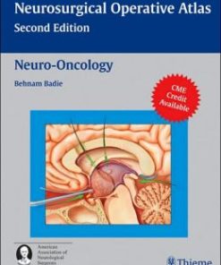 Neuro-Oncology (Neurosurgical Operative Atlas), 2nd Edition