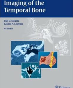 Imaging of the Temporal Bone, 4th Edition