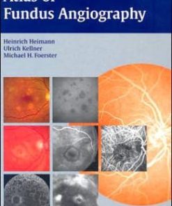 Atlas of Fundus Angiography