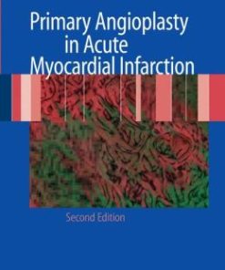 Primary Angioplasty in Acute Myocardial Infarction / Edition 2 (EPUB)