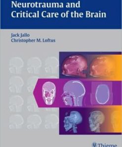 Neurotrauma and Critical Care of the Brain