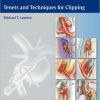 Seven Aneurysms: Tenets and Techniques for Clipping (PDF)