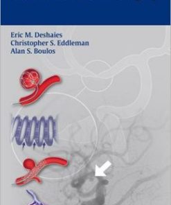 Handbook of Neuroendovascular Surgery