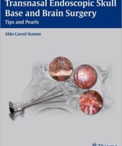 Transnasal Endoscopic Skull Base and Brain Surgery: Tips and Pearls (PDF)